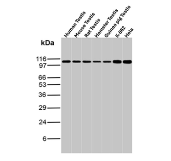 MSH2 Antibody
