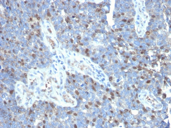 RORC Antibody