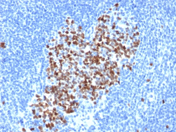 TOP2A Antibody