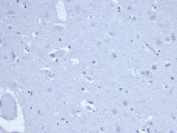 TOP2A Antibody