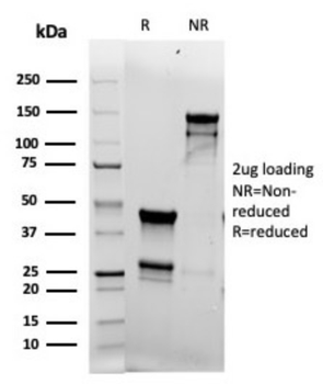 TOP2A Antibody