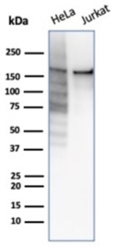 TOP2A Antibody