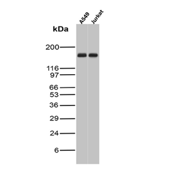 TOP2A Antibody
