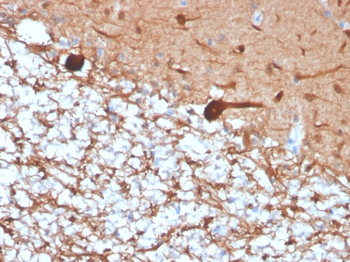 UCHL1 Antibody