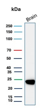 UCHL1 Antibody
