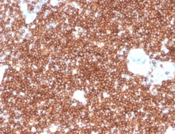 CD4 Antibody