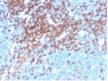 CD4 Antibody