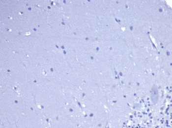CD5 Antibody
