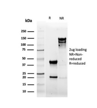 CD5 Antibody