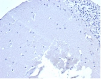 CD5 Antibody
