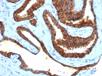 CD38 Antibody