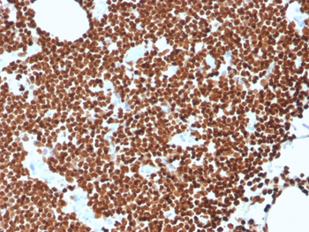 Recombinant Double Stranded DNA (dsDNA) (Nuclear Marker) Antibody