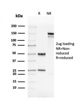 Recombinant Double Stranded DNA (dsDNA) (Nuclear Marker) Antibody