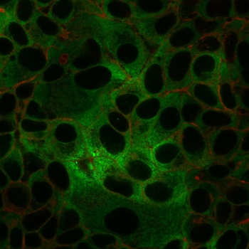 Recombinant Double Stranded DNA (dsDNA) (Nuclear Marker) Antibody
