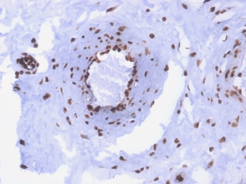 Recombinant Double Stranded DNA (dsDNA) (Nuclear Marker) Antibody