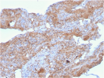 Fn1 Antibody