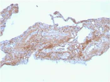 Fn1 Antibody