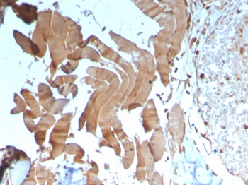 CKM Antibody