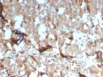 CKM Antibody