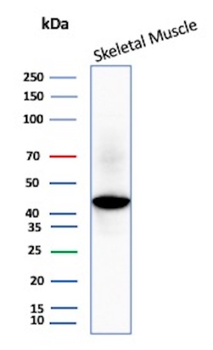 CKM Antibody