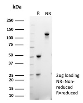 CKM Antibody