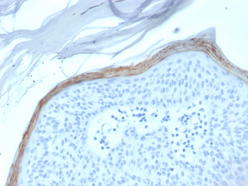 KLK5 Antibody