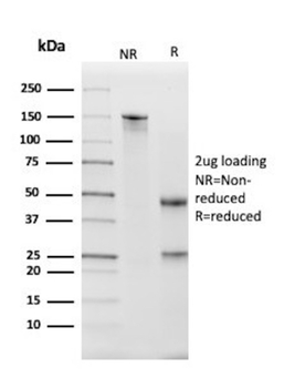 KLK5 Antibody