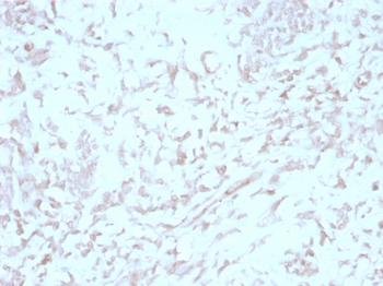 FERMT1 Antibody