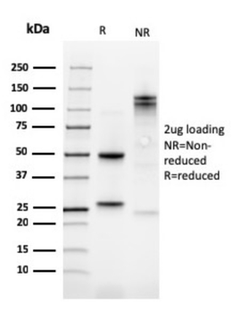 FERMT1 Antibody