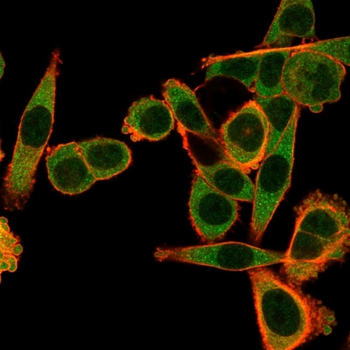 SPIC Antibody