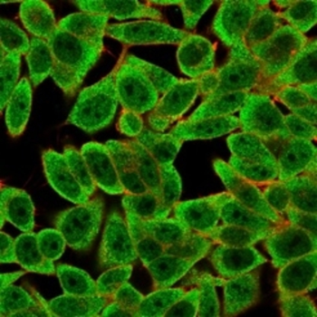 ZBTB7B Antibody