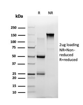 ZBTB7B Antibody