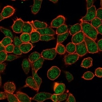 ZBTB7B Antibody