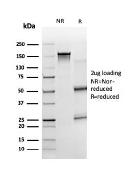 ZBTB7B Antibody