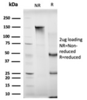 MBNL3 Antibody