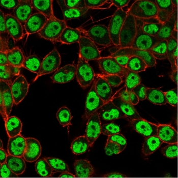 SMARCC1 Antibody