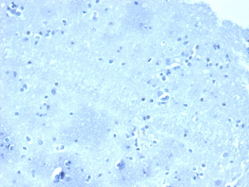 CTNND1 Antibody