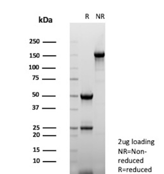 CTNND1 Antibody