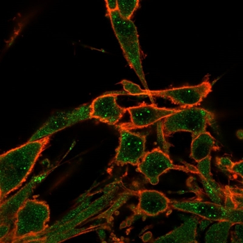 DAXX Antibody