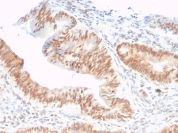 CSTF2T Antibody