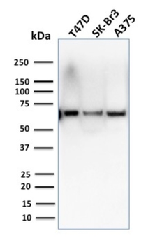 CSTF2T Antibody