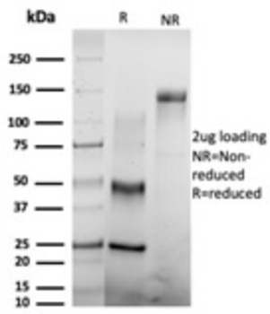 CSTF2T Antibody