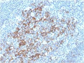 CD23 (Fc Epsilon RII) Antibody