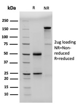 CD23 (Fc Epsilon RII) Antibody