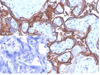 ALPP Antibody