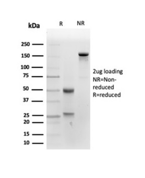 ALPP Antibody