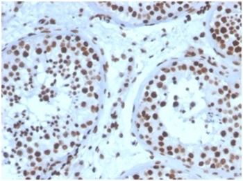 NR5A1 Antibody