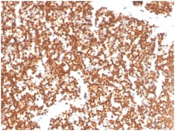 NR5A1 Antibody