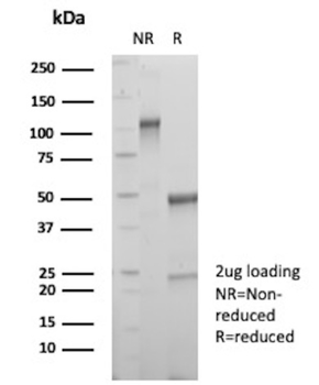 NR5A1 Antibody