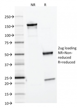 Ferritin, Light Chain (Node-Negative Breast Tumor Prognostic Marker) Antibody